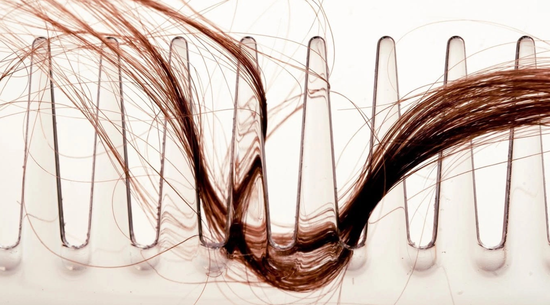 Hair Loss, Shedding & Fragile Hair: Why Nutrition Matters More Than You Think