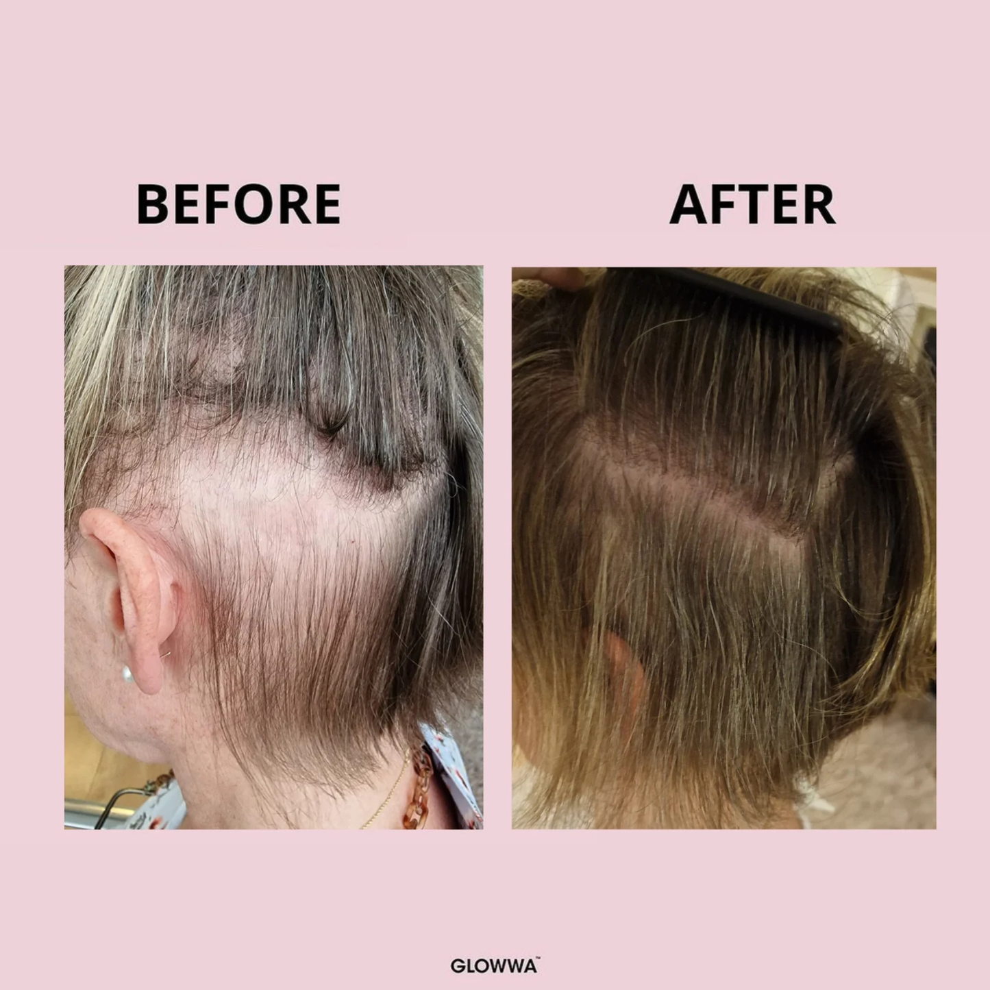 Before and after comparison of hair treatment on a pink background with 'GLOWWA' branding.