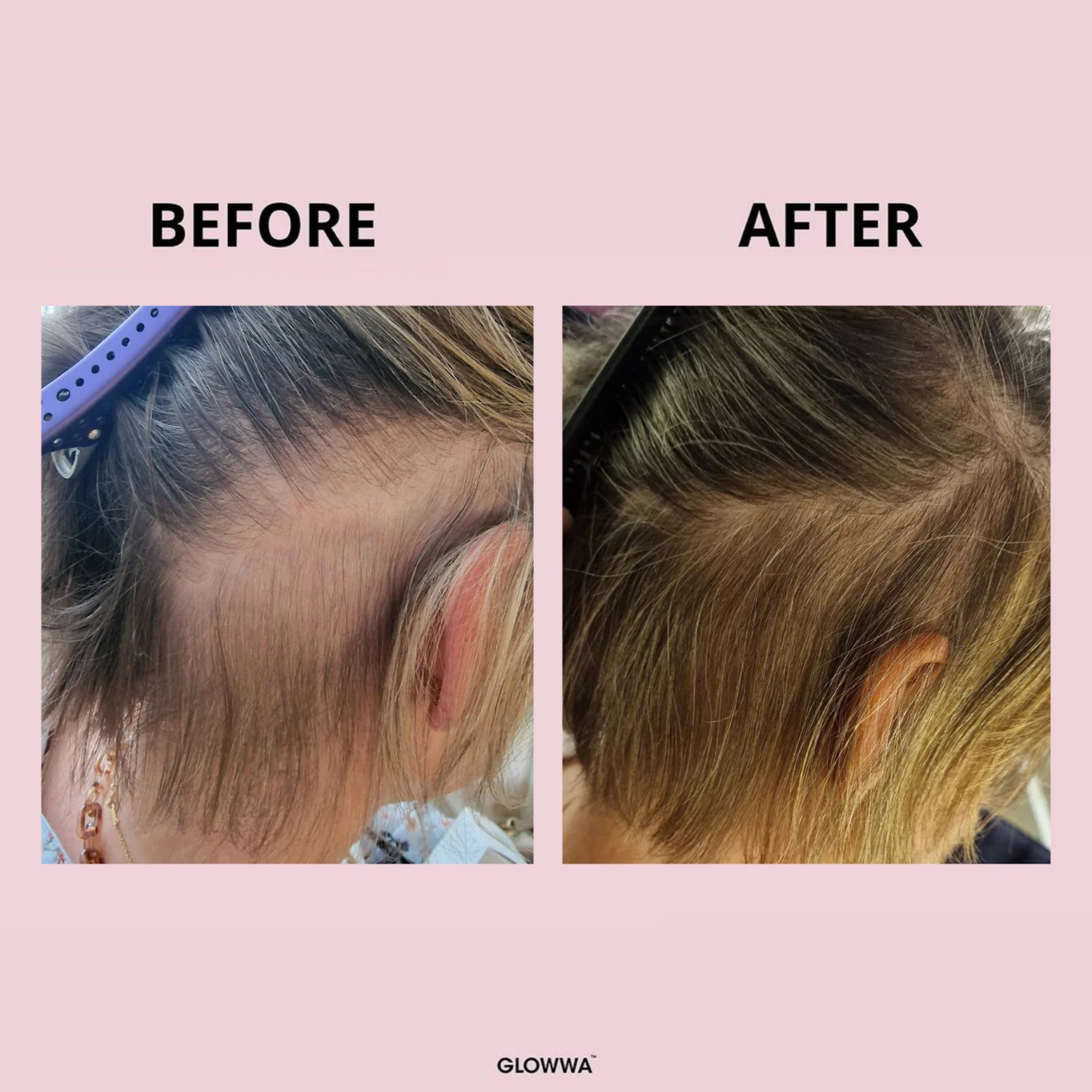 Before and after comparison of hair treatment with 'GLOWWA' branding on a pink background.